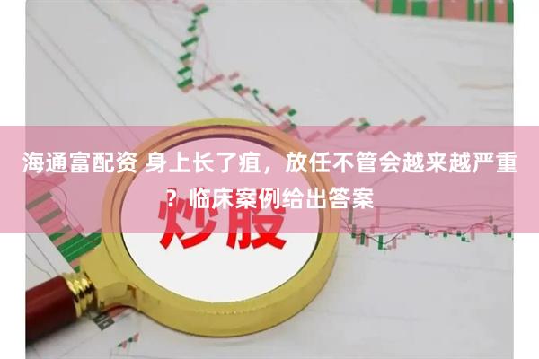 海通富配资 身上长了疽，放任不管会越来越严重？临床案例给出答案